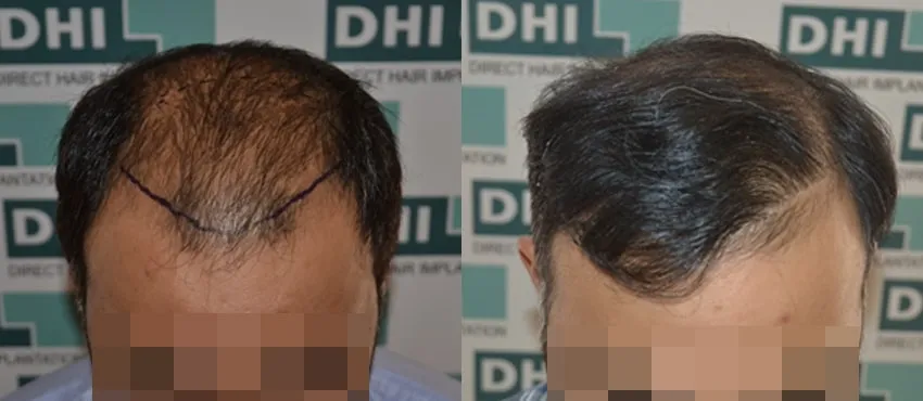 virendra sehwag before and after images