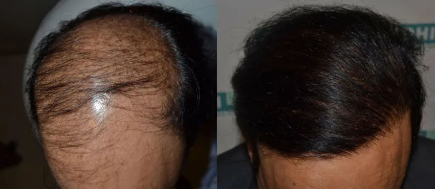 virendra sehwag before and after