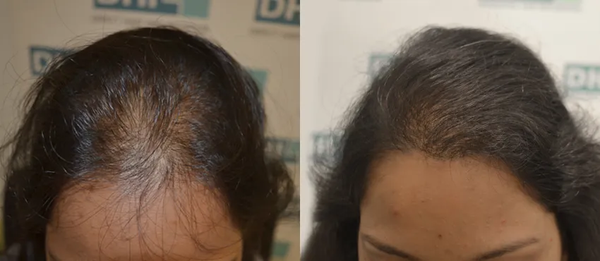dhi before and after image 2 