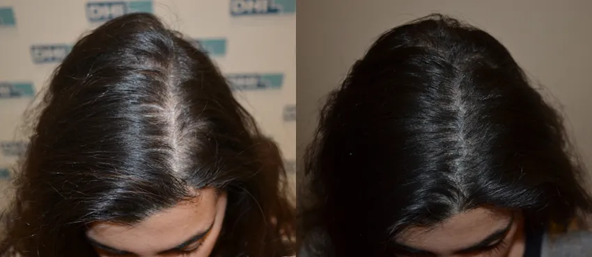 dhi before and after image 3