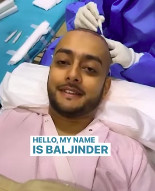 hair transplant video 1