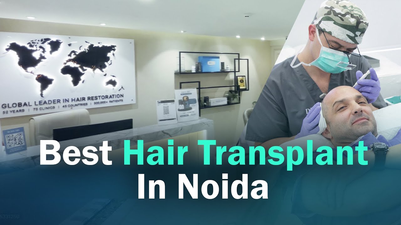 hair transplant video 1