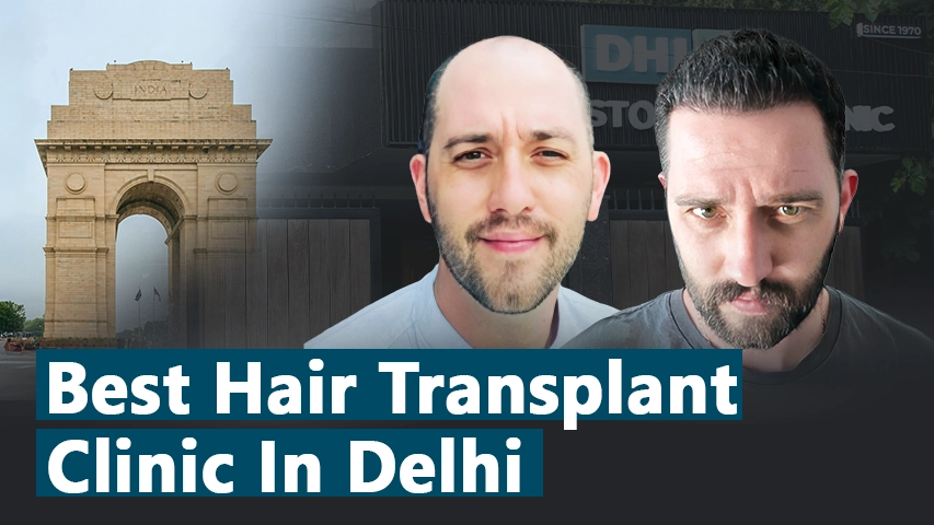 hair transplant video 1