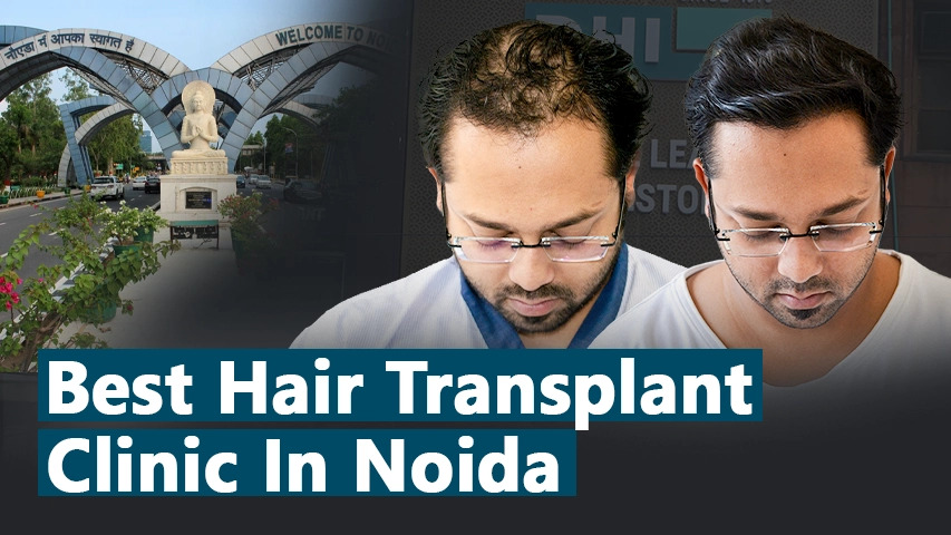 hair transplant video 1