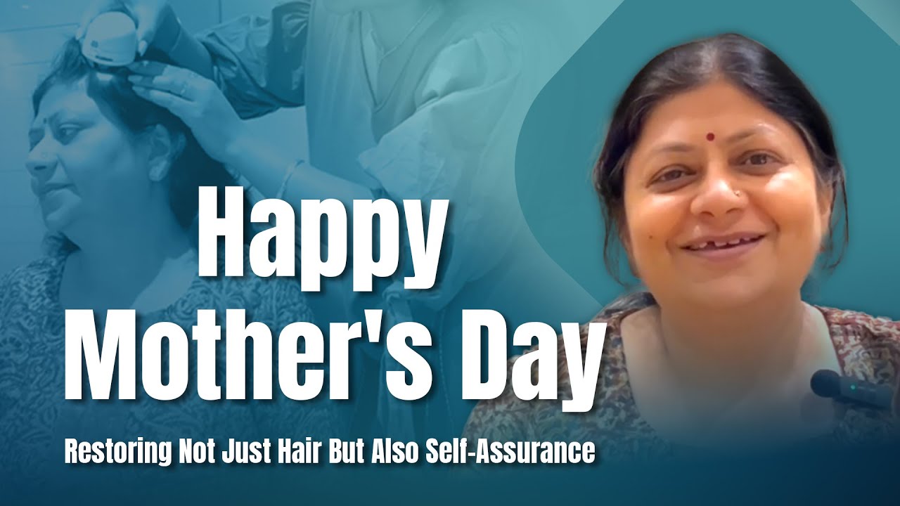 hair transplant video 1