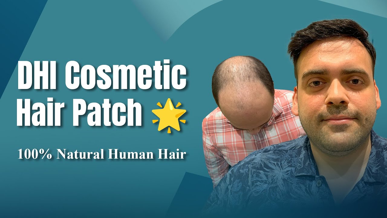 hair transplant video 1