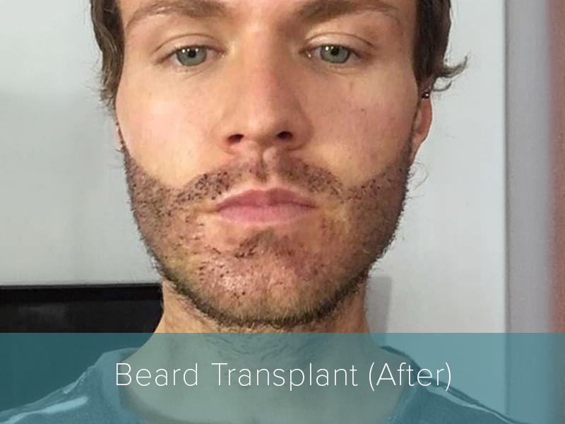 medical tourism dhi india