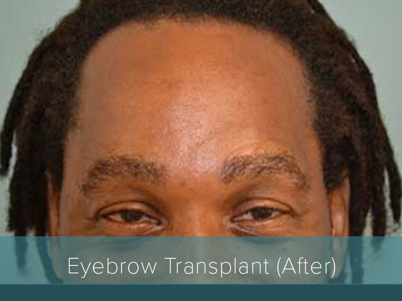 medical tourism dhi india